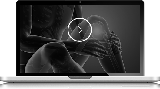 Enhanced Early Recovery Video